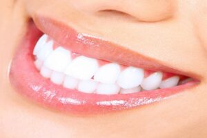 How to whiten your teeth?